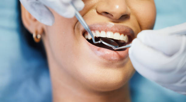 Best Emergency Tooth Extraction in Nashville, TN